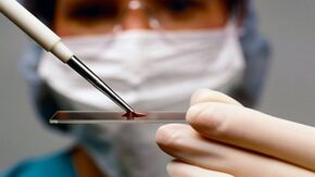 Διάγνωση αρθρόνων και αρθρίων