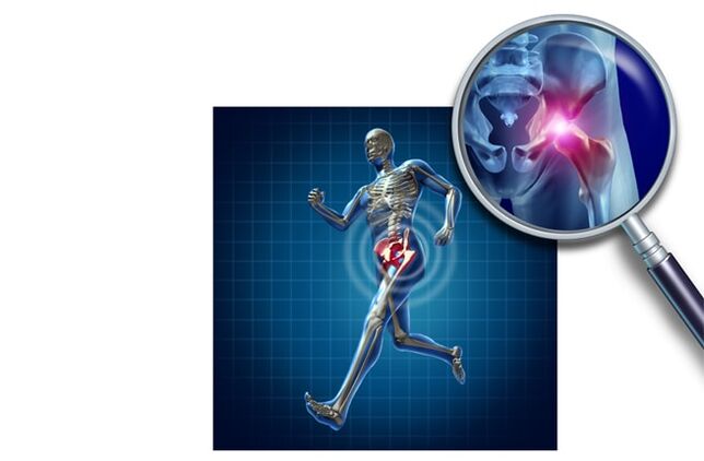 Πόνο όταν τρέχει στην άρθρωση του ισχίου